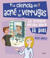 Portada de *La ciencia del acné y las verrugas