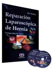 Portada de Reparación Laparoscópica de Hernia