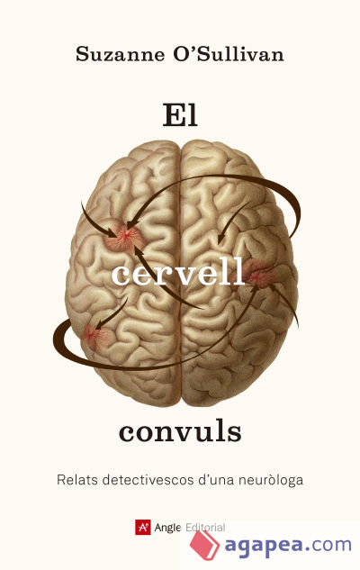 El cervell convuls