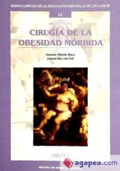 Portada de Cirugía de la obesidad mórbida