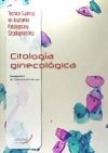 Citología Ginecológica
