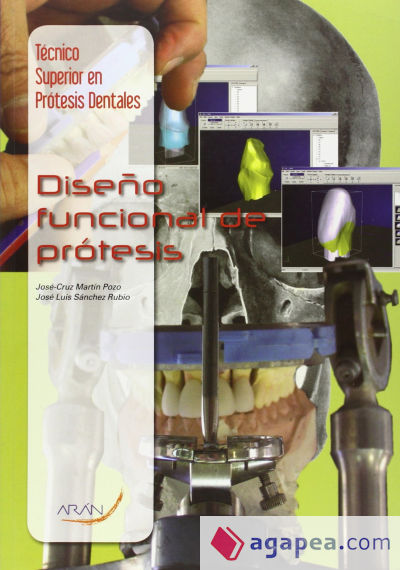Diseño funcional de prótesis