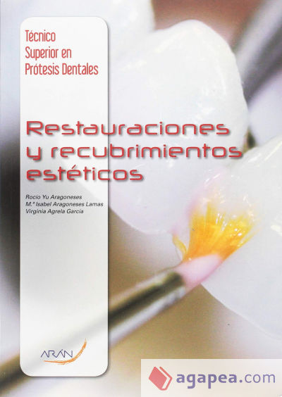 Restauraciones y recubrimientos estéticos