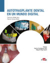 Autotrasplante dental en un mundo digital