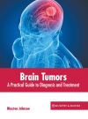 Brain Tumors: A Practical Guide to Diagnosis and Treatment