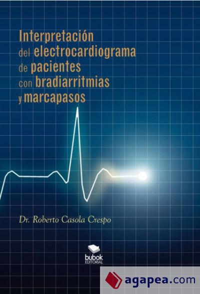 Interpretación del electrocardiograma de pacientes con bradiarritmias y marcapasos (Ebook)