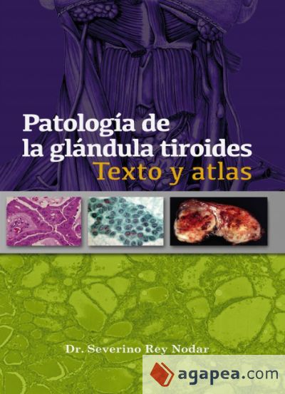 Patología de la glándula tiroides Texto y Atlas (Digital) (Ebook)