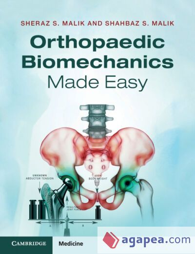 Orthopaedic Biomechanics Made Easy Orthopaedic Biomechanics Made Easy