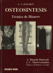Portada de Osteosintesis: Tecnica de Ilizarov