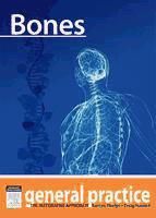 Portada de Bones (Ebook)