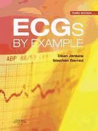 Portada de ECGs by Example E-Book (Ebook)