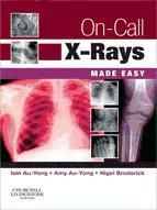 Portada de On-Call X-Rays Made Easy E-Book (Ebook)