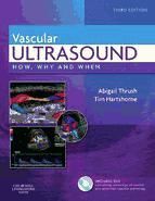 Portada de Vascular Ultrasound E-Book (Ebook)