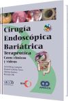 Cirugía Endoscópica Bariátrica