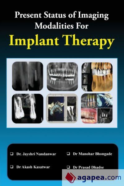 Present Status of Imaging Modalities For Implant Therapy
