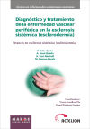 Diagnóstico y tratamiento de la enfermedad vascular periférica en la esclerosis sistémica (esclerodermia)