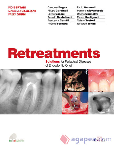 RETREATMENTS SOLUTIONS FOR PERIAPICAL DISEASES OF ENDODONTIC ORIGIN