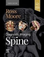 Portada de Diagnostic Imaging: Spine