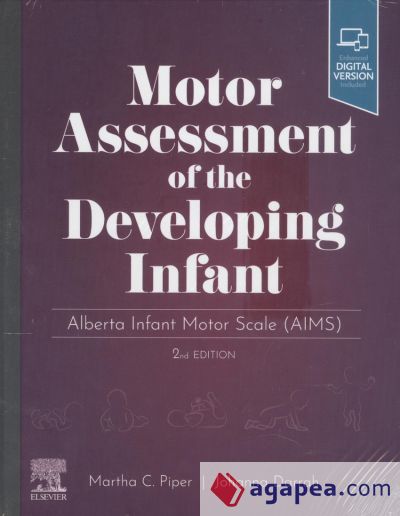 Motor Assessment of the Developing Infant: Alberta Infant Motor Scale (Aims)