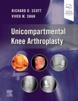 Portada de Unicompartmental Knee Arthroplasty