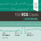 Portada de 150 ECG CASES