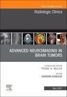 Portada de Advanced neuroimaging in brain tumors