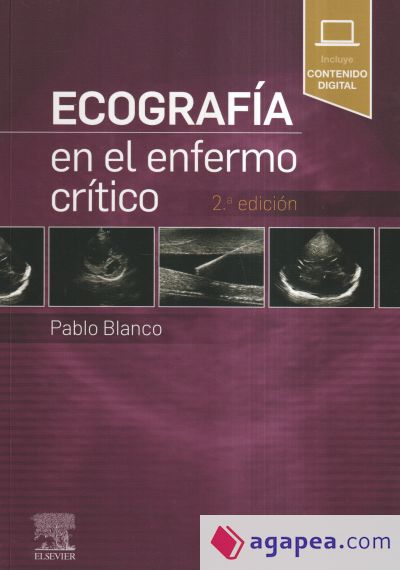 ECOGRAFIA EN EL ENFERMO CRITICO 2ª EDICION