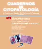 Portada de Citología ginecológica: Infecciones fúngicas. Virus del Papiloma Humano (HPV)