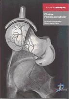 Portada de Choque femoroacetabular (Ebook)