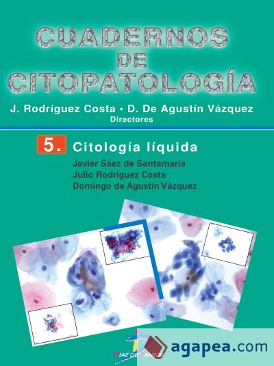 Citología líquida (Ebook)