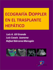 Portada de Ecografía Doppler en el trasplante hepático (Ebook)