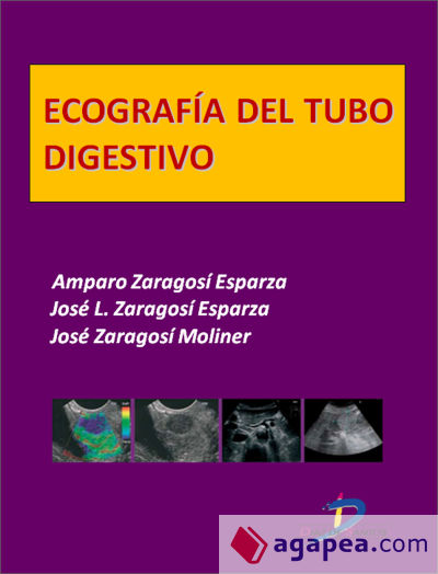 Ecografía del tubo digestivo (Ebook)