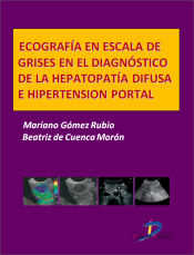 Portada de Ecografía en escala de grises en el diagnóstico dela hepatopatía difusa e hipertensión portal (Ebook)