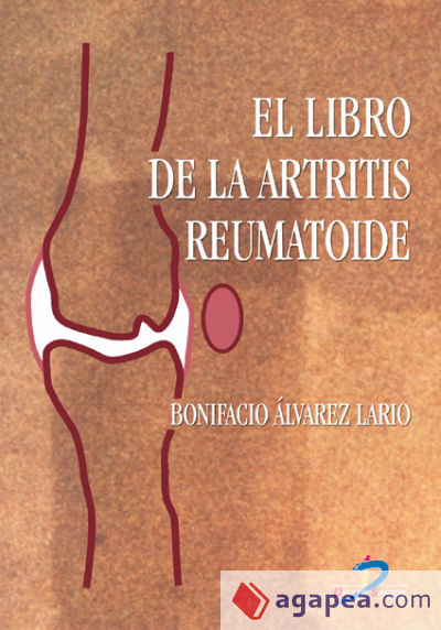 El libro de la artritis reumatoide (Ebook)