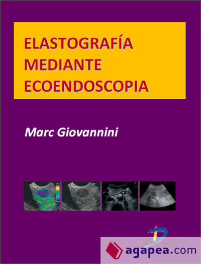 Elastografía mediante ecoendoscopia (Ebook)