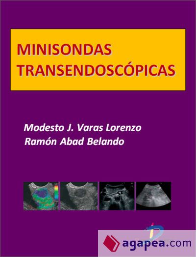 Minisondas transendoscópicas (Ebook)