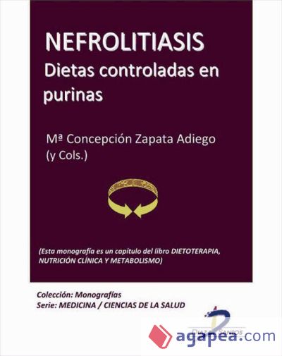 Nefrolitiasis. Dietas controladas en purinas (Ebook)