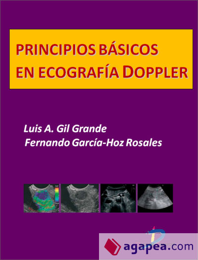 Principios básicos en ecografía Doppler (Ebook)