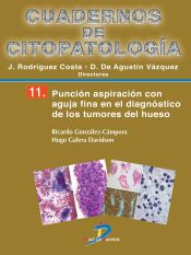 Portada de Punción aspiración con aguja fina en el diagnóstico de los tumores de hueso (Ebook)