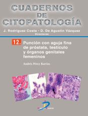 Portada de Punción con aguja fina de próstata, testículo y órganos genitales femeninos (Ebook)