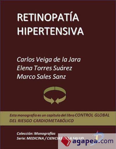 Retinopatía hipertensiva (Ebook)