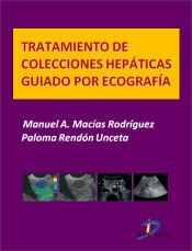 Portada de Tratamiento de colecciones hepáticas guiado por ecografía (Ebook)