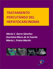 Portada de Tratamiento percutáneo del hepatocarcinoma (Ebook)