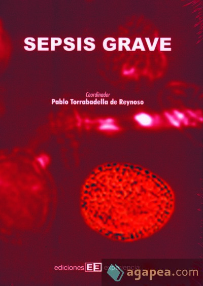 Sepsis grave