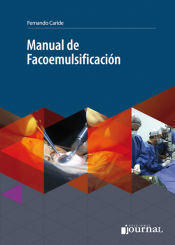 Portada de Manual de facoemulsificación