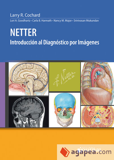 Netter. Introducción al diagnóstico por imágenes