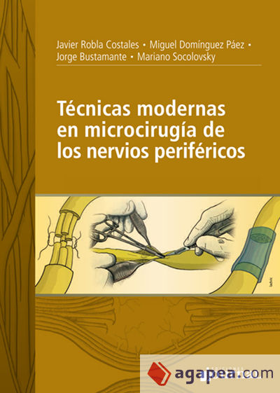 Técnicas modernas en microcirugía de los nervios periféricos