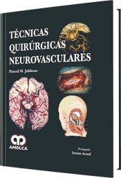 Portada de T&eacute;cnicas quir&uacute;rgicas neurovasculares