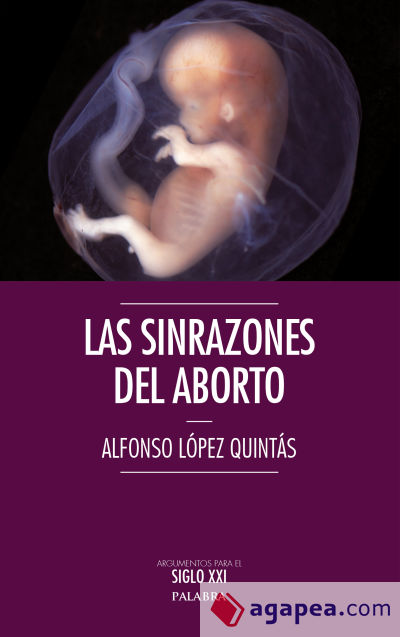 Las sinrazones del aborto