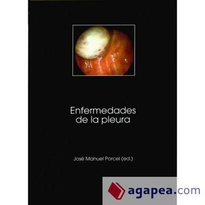 Enfermedades de la pleura. (Ebook)